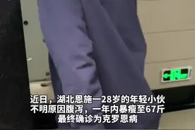 湖北28岁男子不明原因腹泻 ，一年暴瘦至67斤，多地就医均诊断为肠炎 ，但治疗无果，终确诊为克罗恩病  来源：潇湘晨报视频封面