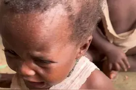 #非洲生活 #双胞胎#小女孩的妈妈被爸爸打跑了，家里太穷了，小孩太可怜了视频封面