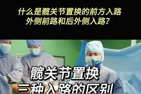 什么是髋关节置换前方入路、外侧入路和后外侧入路？ #股骨头坏死#先天性髋关节发育不良 #髋关节置换#髋关节手术入路#广安关节罗军医生