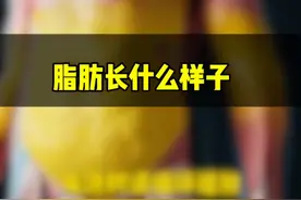 脂肪长什么样子 #减肥 #年后减肥 #袖状胃 #减重手术 #医学减重刘少壮