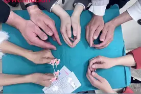 门诊日常#医学科普 #短指甲 #D型短指 #d型短指症 #美甲