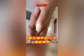 #最伤指甲的不是美甲而是卸甲  #卸掉美甲后为啥指甲会出现红血丝  很多人认为指甲油是化学品，做了美甲后卸甲后就不伤指甲了，实际上卸甲是更伤指甲的行为！当下大部分美甲店卸甲都会使用打磨机将指甲油从指甲上打磨掉，打磨机在磨除指甲油的同时还会打磨掉一层原本的指甲，同时，卸甲后的抛光会进一步将指甲磨薄。打磨机摩擦生热会带来甲床下毛细血管扩张、甲床分离，甚至甲床出血等情况。同时，指甲变薄以后也容易导致指甲出现红血丝、空甲、细菌感染等。#谈谈新知