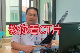 教你看CT片#医学科普 #医学科普仅供参考如有不适请线下就医