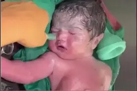 刚刚出生的小婴儿没有呼吸，医生全力抢救 #抖音电脑版 #用电脑刷抖音有多爽 #新生儿视频封面