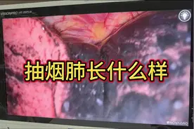 抽烟的肺长什么样#医学科普 #硬核健康科普行动