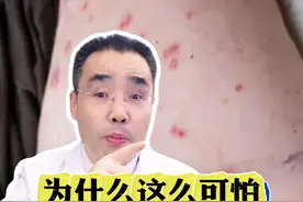 梅毒为什么这么可怕？ #医疗健康创作训练营 #硬核健康科普行动 #梅毒科普