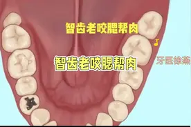 智齿咬腮帮肉#智齿 #口腔科普视频封面