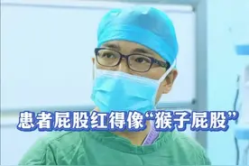 患者屁股红得像“猴子屁股”一样！ #抖出健康知识宝藏 #肛肠健康 #肛肠疾病 #肛肠 #肛肠科 @抖音医疗健康小助手 @抖音健康 @抖音热点 @抖音短视频