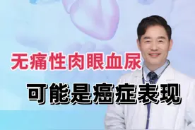 有一种血尿，叫“无痛性肉眼血尿”，可能是癌症表现，一定要重视#无痛性肉眼血尿 #血尿 #肾癌 #膀胱癌 #硬核健康科普行动