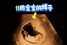 胎宝宝在妈妈肚子里的样子 #胎宝宝在肚子里的状态 #胎宝宝 #胎儿在肚子里的各种姿势 #一般胎儿在肚子里干什么 #胎儿在肚子里都在干什么