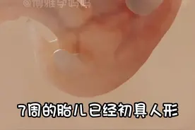 7周的胎儿已经长出小手小脚，大家的宝贝都几周啦#怀孕 #胎儿