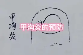 #甲沟炎 #剪指甲 #外科医生 #生活常识 #六院庞医生