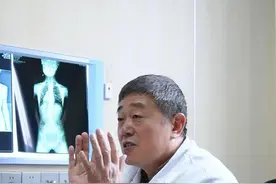 脊柱侧弯拍片子站正站直#脊柱侧弯#骨科#抖出健康知识宝藏#宋相建视频封面