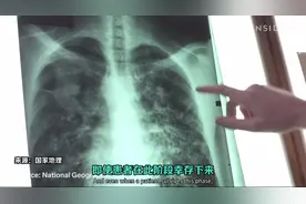 大数据分析：感染新冠病毒后，身体会发生什么变化？视频封面