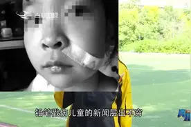 真相123：铅笔戳进小朋友眼睛后果有多严重？这个案例触目惊心视频封面