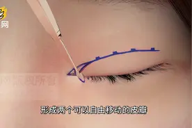 又称开眼角的内眦扩大术,瞬间无痕变大眼,你也是女神视频封面
