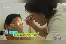 生活圈：翼状胬肉的发生与哪些因素有关，该不该切除？听专家咋说