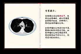 肠癌术后，复查发现肺部结节，有点担心，该怎么办？视频封面
