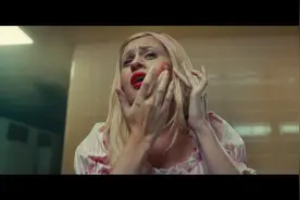 千万不要挤掉脸上的粉刺 看完这个你就知道多恐怖了