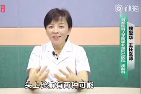 头上长癣用什么药膏