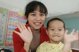 小孩子常常牙齿咬下嘴唇，究竟什么原因？宝妈问完医生长见识了