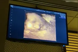 怀孕36周四维彩超产检终于看到了宝宝真容，医生直夸他很漂亮！视频封面