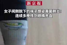 女子闻刚脱下的袜子感染真菌肺炎，连续多晚咳到眼睛充血图片