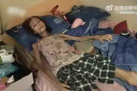 震惊！爱情的力量？女子为男友从130斤暴瘦至31斤，却换来了……图片
